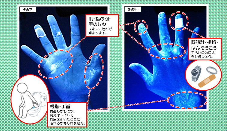 手洗い実験の画像