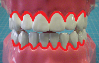 歯と歯肉の境目の写真