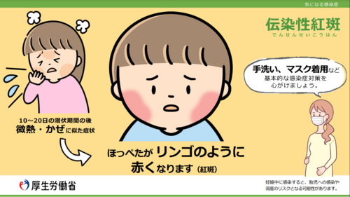 伝染性紅斑について（厚生労働省）