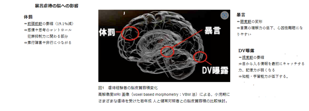 虐待による脳への影響